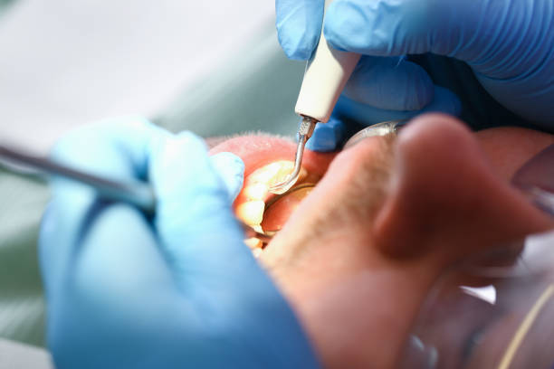 Dentist for Dental Trauma in MO