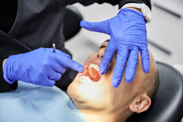 Best Knocked-Out Tooth Emergency  in Washington, MO